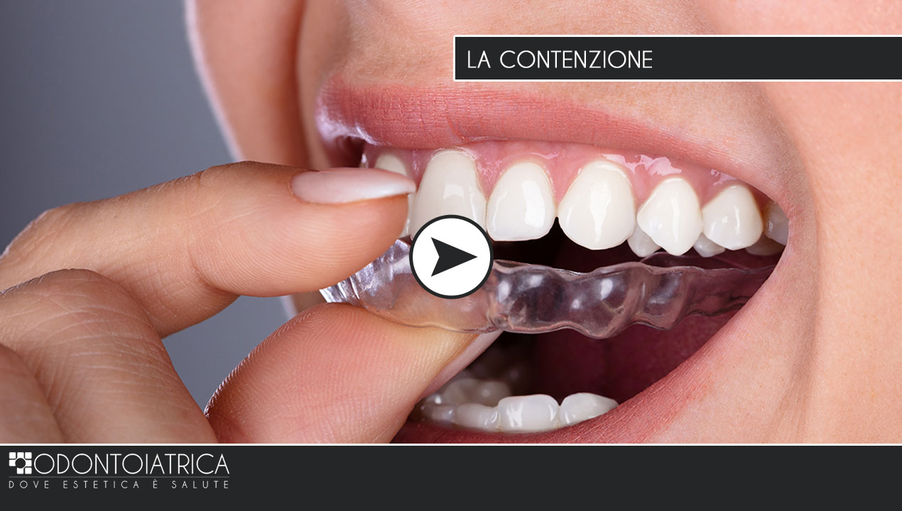 Esperti in estetica e cosmesi dentale, sbiancamento e faccette, Odontoiatrica Clinica dentale a Marcon e dentista a Mirano - Venezia