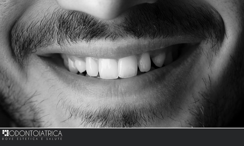 Esperti in estetica e cosmesi dentale, sbiancamento e faccette, Odontoiatrica Clinica dentale a Marcon e dentista a Mirano - Venezia