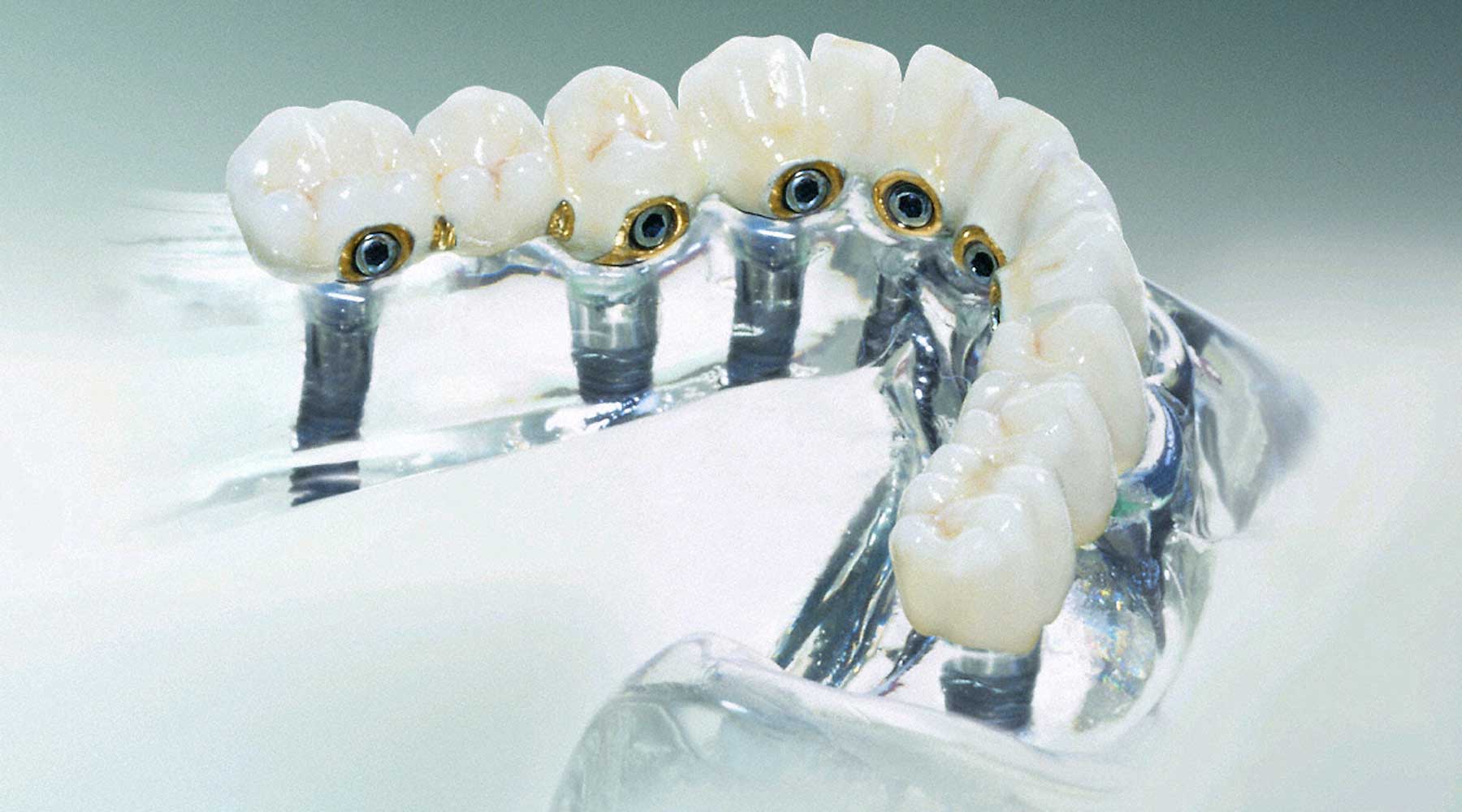 Esperti in estetica e cosmesi dentale, sbiancamento e faccette, Odontoiatrica Clinica dentale a Marcon e dentista a Mirano - Venezia